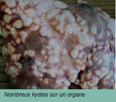 Nombreux kystes sur un organe