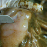 Les strongyloses gastro-intestinales