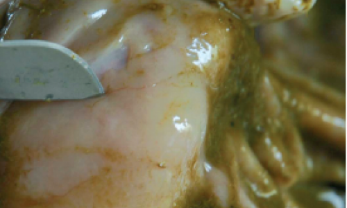 Les strongyloses gastro-intestinales