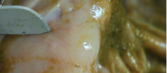 Les strongyloses gastro-intestinales