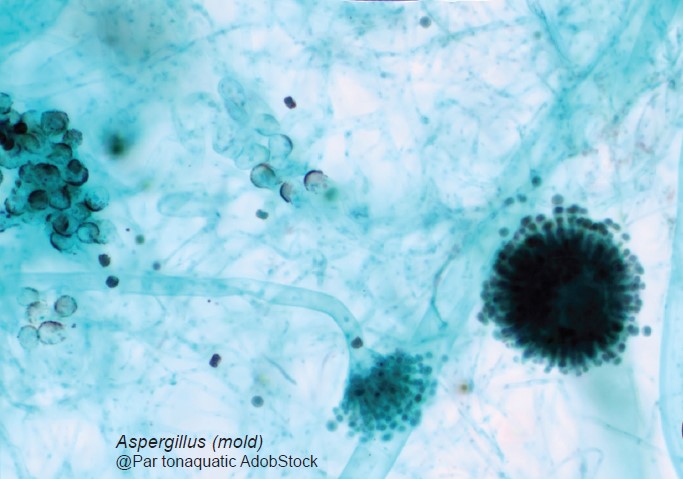 Les mycotoxines  en élevage