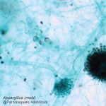 Les mycotoxines  en élevage