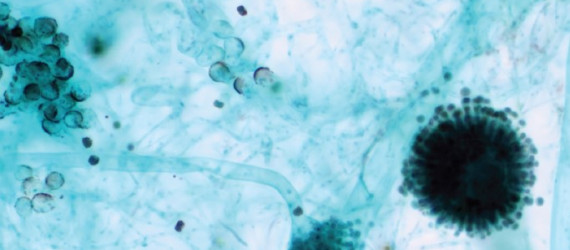 Les mycotoxines  en élevage
